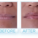 lip6 thumnail